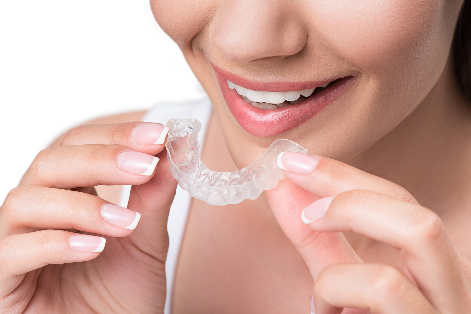 5 benefits of invisalign