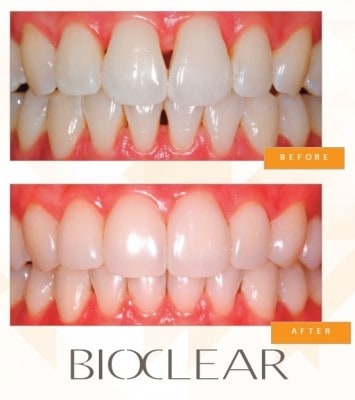 bioclear image