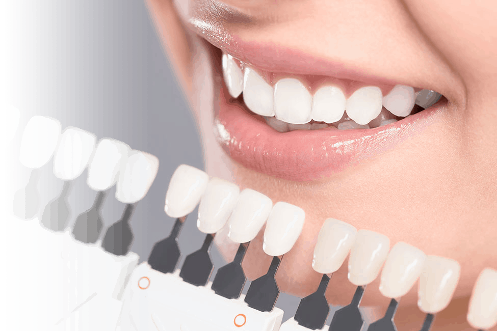 cosmetic dentistry in millwoods