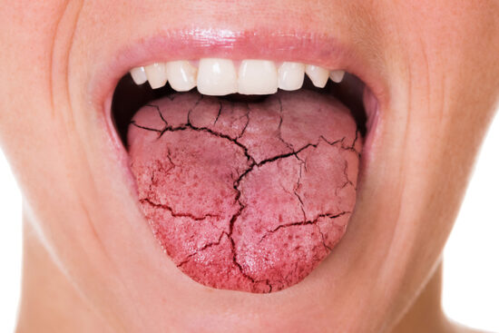the truth about dry mouth