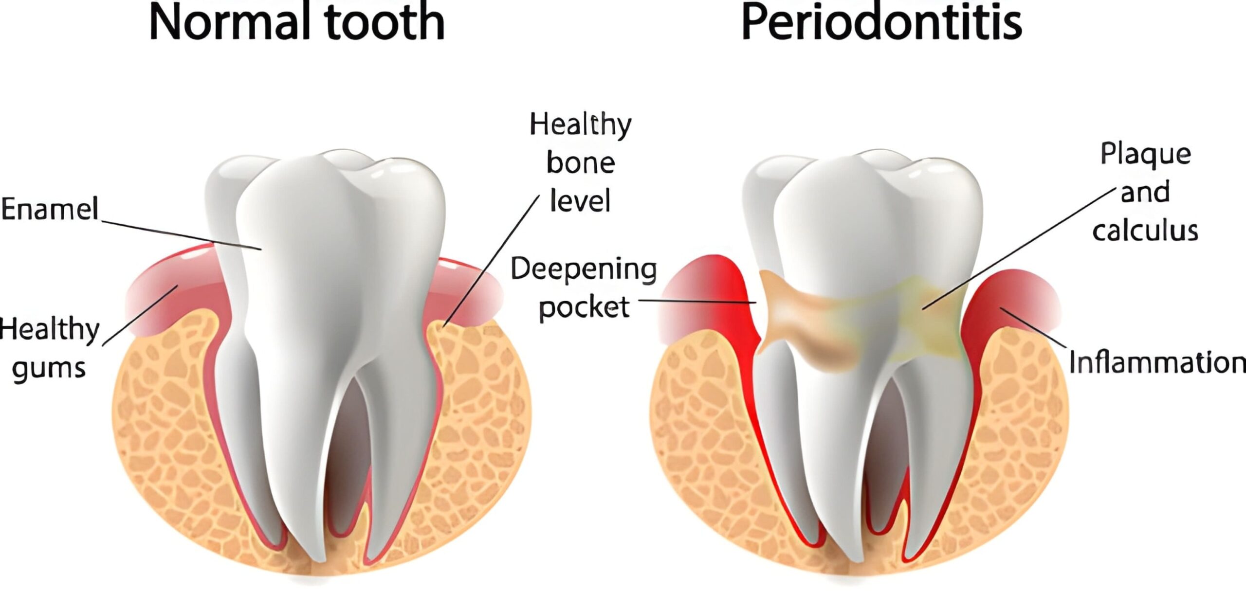 periodontal treatment in Millwoods