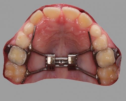 orthodontic treatment southeast edmonton